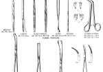 TONSIL. (Surgical instruments)