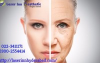 Laser Inn Aesthetic Surgery Centre Hyderabad