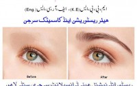 Best Hair Transplant in Pakistan