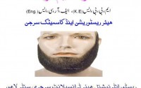 Best Hair Transplant in Pakistan