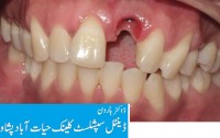 Dr. Haroon Dental Specialist Clinic Hayatabad Peshawar