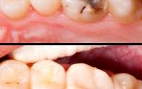 Dr. Haroon Dental Specialist Clinic Hayatabad Peshawar