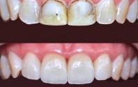 Dr. Haroon Dental Specialist Clinic Hayatabad Peshawar