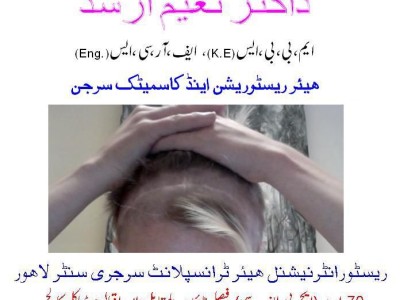 Best Hair Transplant in Pakistan - photo 2