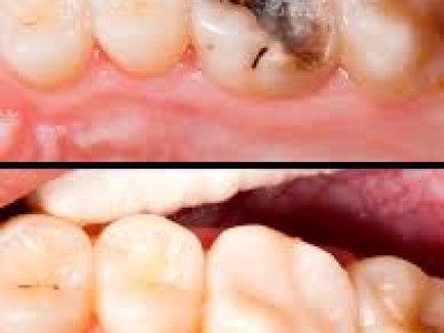 hayatabad best dental clinic in Peshawar, Dr Haroon Dental specialist clinic Hayatabad Peshawar, Best Dentist in Peshawar, Best Dental Doctor in Peshawar, Implant dentist in hayatabad,  Implant dentist Peshawar, Dentist Near me Peshawar, for rct, filling,