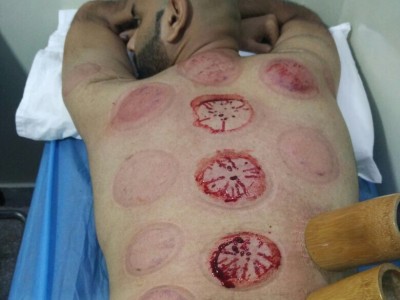 Chinese Hijama Center Lahore | ZhongBa Hospital - photo 1