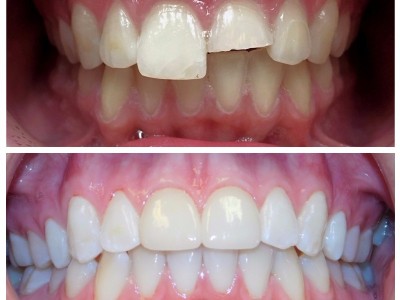 hayatabad best dental clinic in Peshawar, Dr Haroon Dental specialist clinic Hayatabad Peshawar, Best Dentist in Peshawar, Best Dental Doctor in Peshawar, Implant dentist in hayatabad,  Implant dentist Peshawar, Dentist Near me Peshawar, for rct, filling,