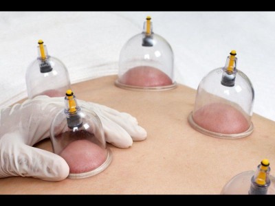 Chinese Hijama Center Lahore | ZhongBa Hospital - photo 3