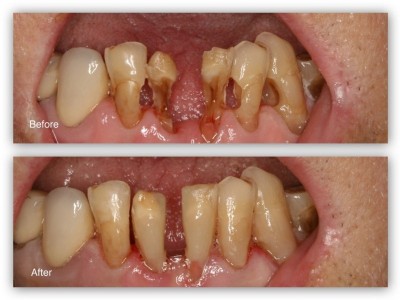 best dental clinic in Peshawar Pakistan, Dr Haroon Dental specialist clinic Hayatabad Peshawar Pakistan, Best Dentist in Peshawar Pakistan, Best Dental Doctor in Peshawar Pakistan, Implant dentist in hayatabad,  Implant dentist Peshawar Pakistan, Dentist