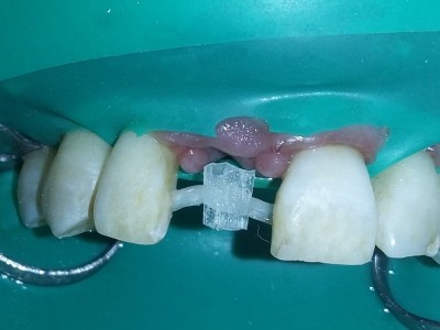 Shafqat Dental Clinic and Implant centre - photo 1