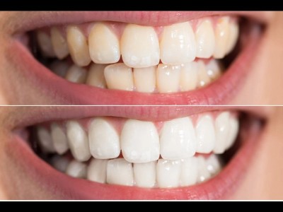 best dental clinic in Peshawar Pakistan, Dr Haroon Dental specialist clinic Hayatabad Peshawar Pakistan, Best Dentist in Peshawar Pakistan, Best Dental Doctor in Peshawar Pakistan, Implant dentist in hayatabad,  Implant dentist Peshawar Pakistan, Dentist